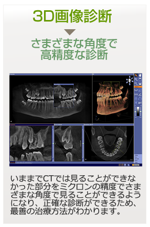 3D画像診断|いままでCTでは見ることができなかった部分をミクロンの精度でさまざまな角度で見ることができるようになり、正確な診断ができるため、最善の治療方法がわかります。