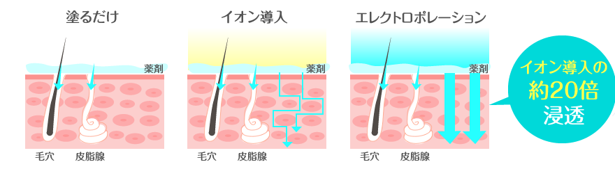 エレクトロポレーション