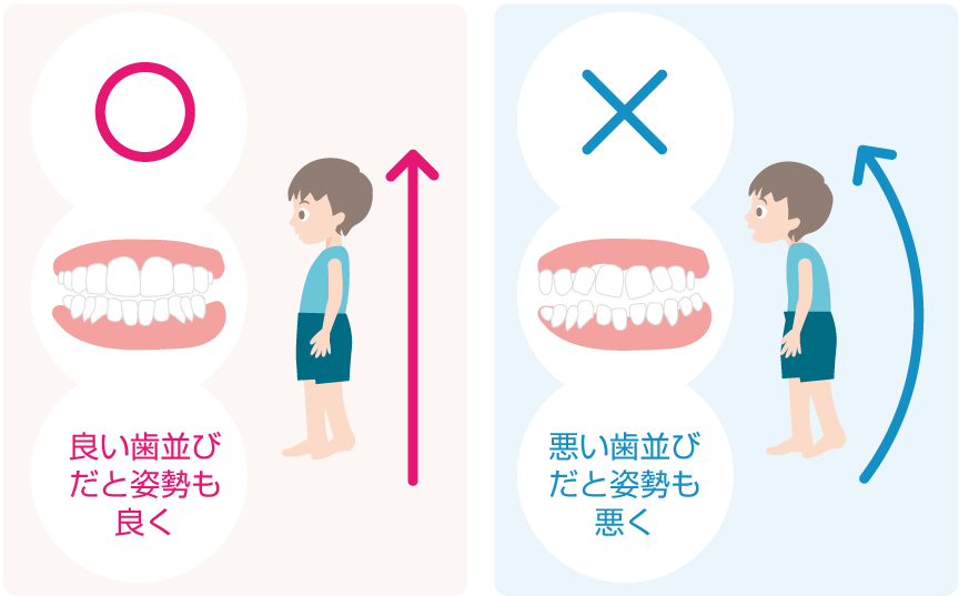 歯並びと姿勢